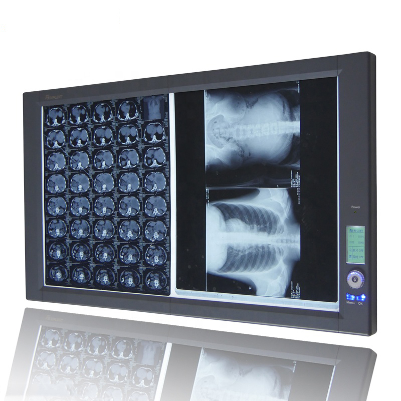 LED X-Ray Film View Box(2A)