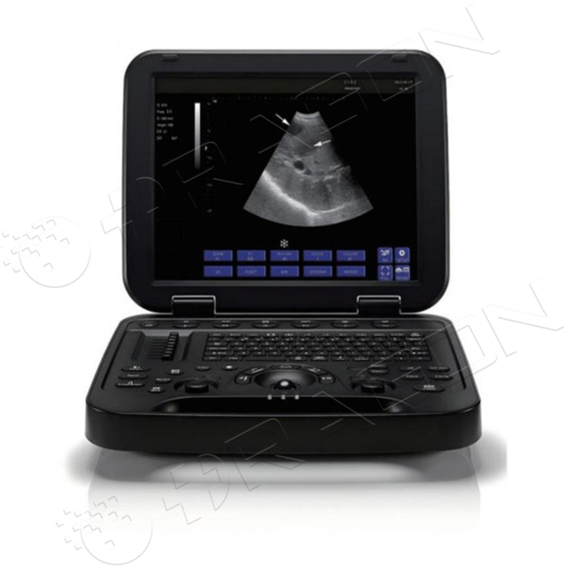 超音波診断装置 RAD-US06